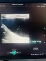 Полина В, изображение к комментарию.